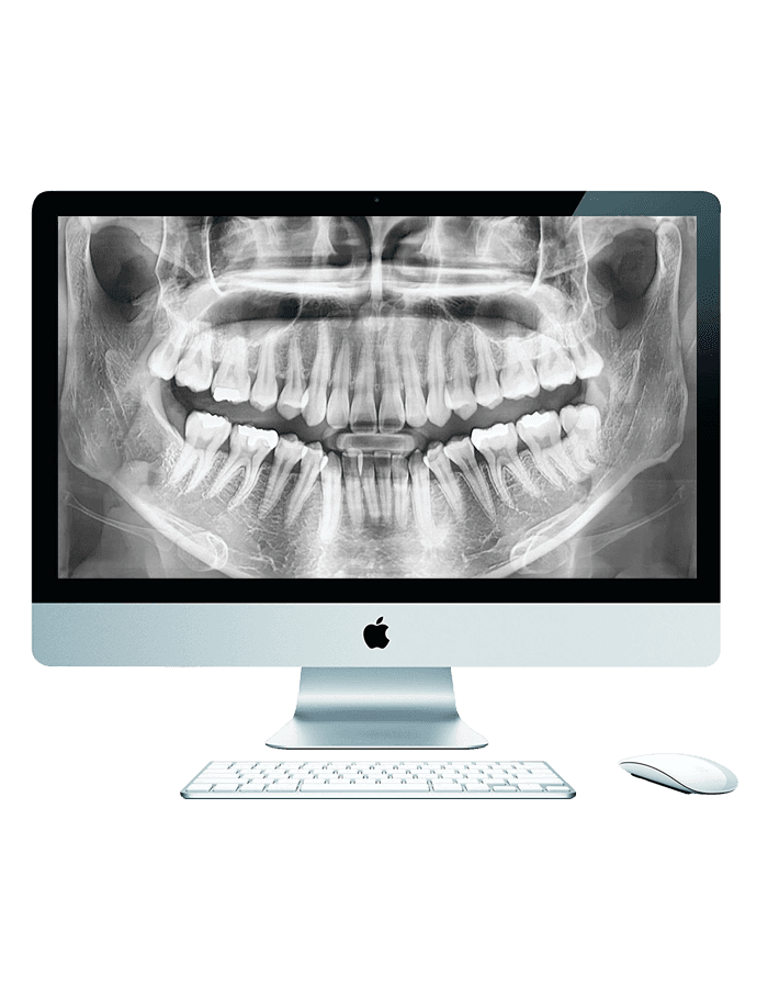 The image shows a sleek and modern CAD/CAM dental device on a clean, white background. The machine is primarily white and silver with a compact, rectangular shape, designed for precision dental work.